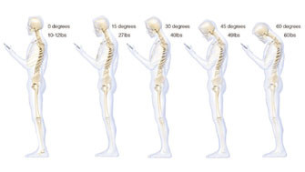 Смартфоны портят осанку